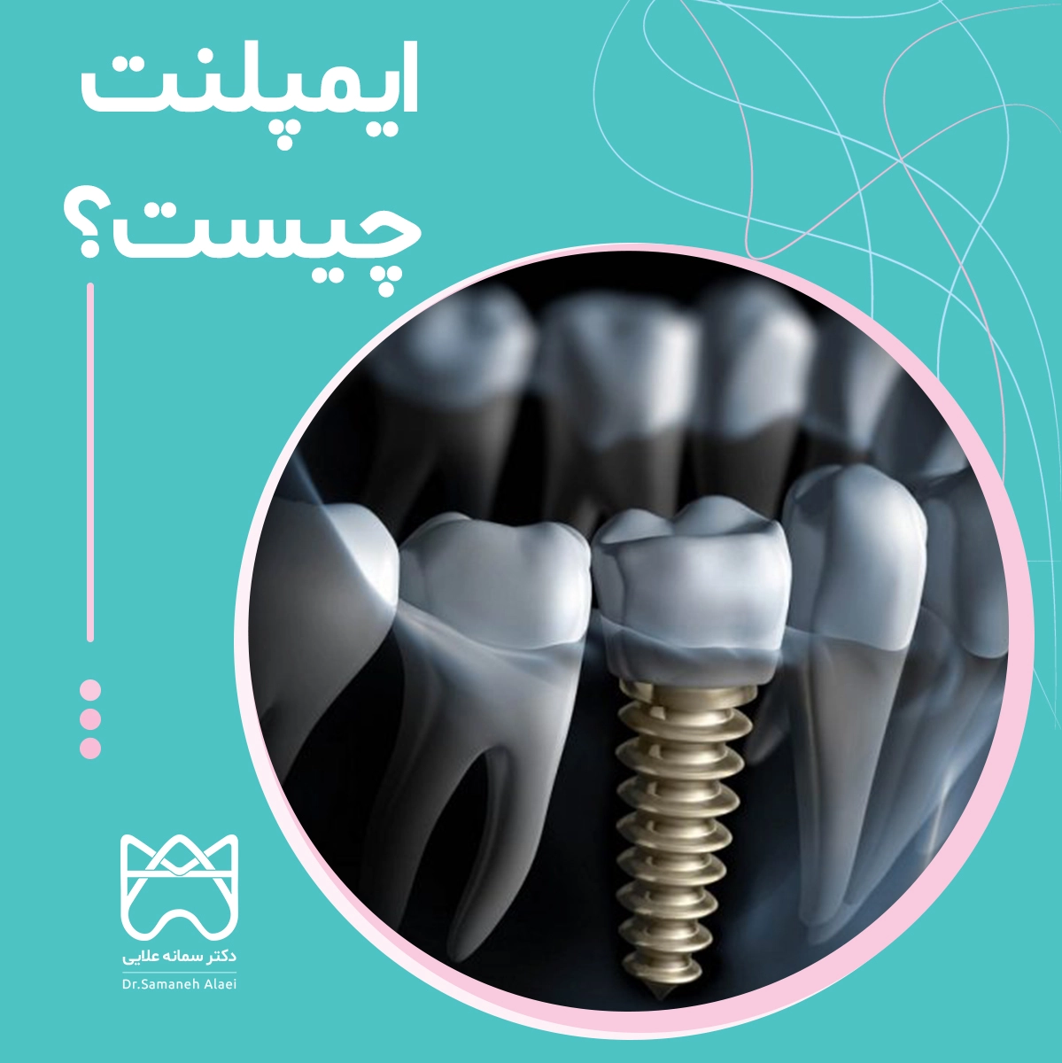 پست اینستاگرام